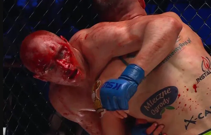 KSW 102: Krwawy powrót i nokaut obrotówką! [WIDEO]