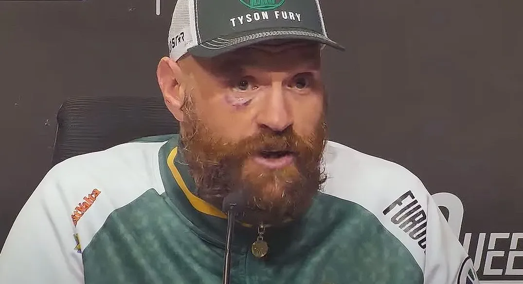 Whyte o tym, jak Usyk przechytrzył Fury’ego w rewanżu