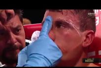 Видео боя: Клетус Селдин — Роберто Ортис, HD 1080 Видео боя: Клетус Селдин — Роберто Ортис, HD 1080