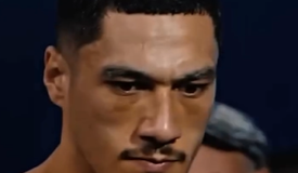 Бой Опетая–Скуэо состоится позже: у чемпиона травма Бой Опетая–Скуэо состоится позже: у чемпиона травма