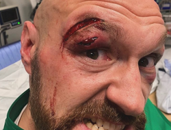 фото - Уайта попросили назвать фаворита боя Фьюри-Усик