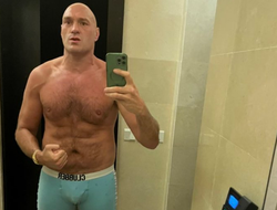 фото - Стало известно, как Фьюри получил рассечение, из-за которого слетел бой с Усиком. Держите видео