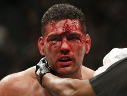 фото - UFC 199: Уайдман травмирован, Рокхолду ищут нового соперника