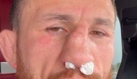 Бой Ян – Двалишвили 3 на грани срыва? Мераб травмировал нос