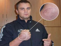 фото - Денису Бойцову сделана очередная операция на бьющей руке