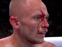 фото - Битва экс-чемпионов: окровавленный Эдвардс прошёл Куриэля — видео