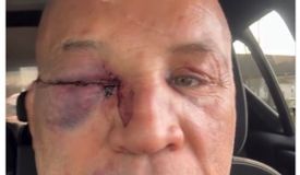 Легендарного Силву нокаутировали в драке. Стало известно, кто срубил экс-чемпиона