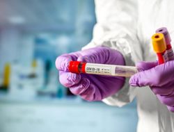 фото - Шоу Боба Арума обмельчало из-за позитивного теста на коронавирус