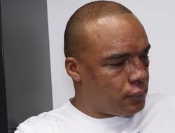 фото - Уордли даст реванш Хуни? Боец нацелен на Усика и Дюбуа