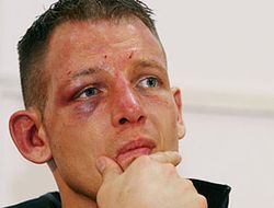 фото - Одной строкой: возвращение Ульриха, Тайберт, Хоффман