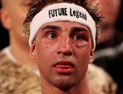 фото - Рассечение не позволит Малиньяджи вернуться 29 мая