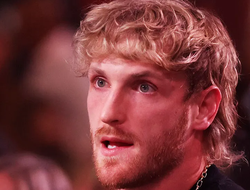 фото - Логан Пол получил кучу травм в поединке за титул чемпиона WWE: фото