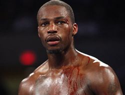 фото - Чед Доусон: «Уорд – обычный боец, нет в нем ничего особенного»