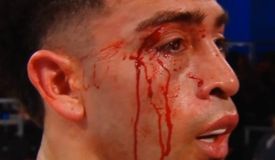 Экс-чемпион Валенсуэла побил Торреса в главном бою Zuffa Boxing 2: видео