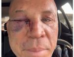 Легендарного Силву нокаутировали в драке. Стало известно, кто срубил экс-чемпиона