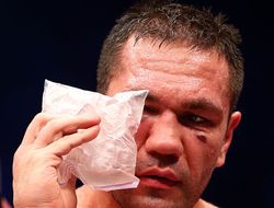 фото - Кубрат Пулев: о поражении, уважении к Кличко, допинге и будущем