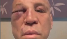 Легендарный Силва решил засудить обидчика за нокаут в драке