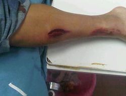 фото - Фернандо Монтиэль упал с мотоцикла