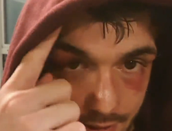 фото - Йигит после поражения Беринчику обвинил в халатности Красюка. Это очень серьёзные обвинения