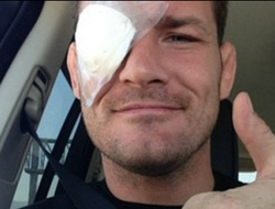 фото - Майклу Биспингу сделали успешную операцию по коррекции зрения