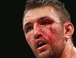 фото - Окровавленный Фьюри досрочно победил Касси