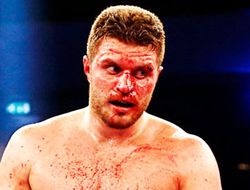 фото - Эдмунд Гербер предлагает Дереку Чисоре услуги психоаналитика