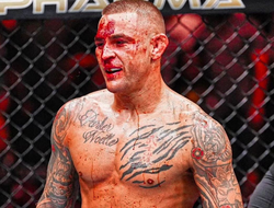 фото - Порье хорошо досталось в бою с Махачевым. Дастин рассказал о полученных травмах