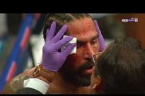 Видео боя: Антонио Маргарито — Карсон Джонс