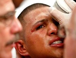 фото - У Фернандо Варгаса – пневмония, возвращение в ринг отложено