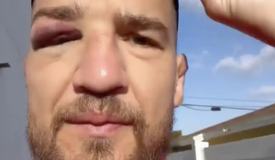 Амосов получил травму за несколько дней до боя на UFC 328