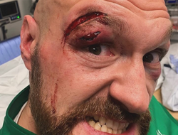 фото - Рассечение Фьюри может раскрыться в бою с Усиком? Неутешительный вердикт катмена