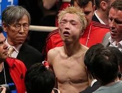 фото - Гильермо Ригондо сломал японцу челюсть и орбиту глаза