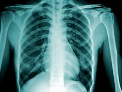 фото - Перенесен бой Брука с Чавесом: причина – травма британца