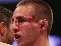 фото - (ММА) Рори Макдональд и Карлос Кондит выявят сильнейшего на UFC 158