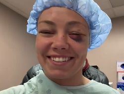 фото - «Молитесь за меня». В глаз экс-чемпионке UFC установят силиконовую трубку