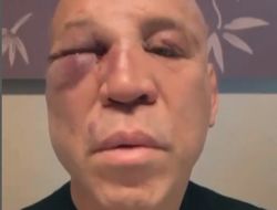 фото - Легендарный Силва решил засудить обидчика за нокаут в драке