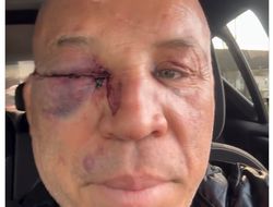 фото - Легендарного Силву нокаутировали в драке. Стало известно, кто срубил экс-чемпиона