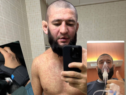 фото - Чимаев напугал болельщиков признанием: «Я был очень болен»