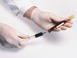 фото - Мэнни Пакьяо прошёл первый случайный допинг-тест