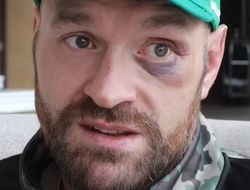 фото - Нганну взял раунд с нокдауном и ещё какой-то, и всё: мнение Фьюри