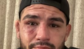 Эрнандес прокомментировал поражение Стриклэнду