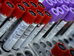 фото - Антидопинговые организации объявили о сокращении количества проводимых тестов