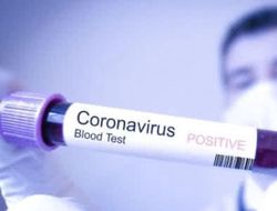 фото - Два члена сборной Турции по боксу вернулись из Лондона с коронавирусом