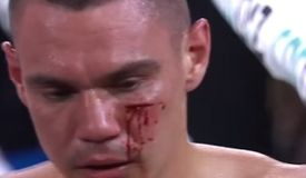 Окровавленный Цзю побил Нурью: видео