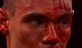 Тим Цзю: «Я подумал, обычно кровь так не брызжет…»