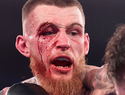 фото - Хьюз избил Калли, Куриленко взял пояс чемпиона Украины