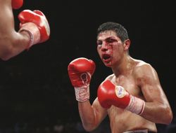 фото - Много крови: Кано победил проспекта Мадиева техническим решением