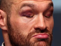 фото - Фьюри раздражён Макгрегором: Да какое там ММА...