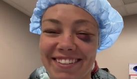 «Молитесь за меня». В глаз экс-чемпионке UFC установят силиконовую трубку