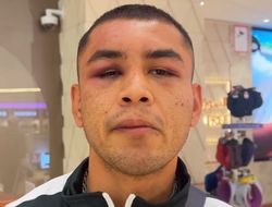 фото - Эрнандес пересмотрел бой с Накатани: «Сделал достаточно для победы»